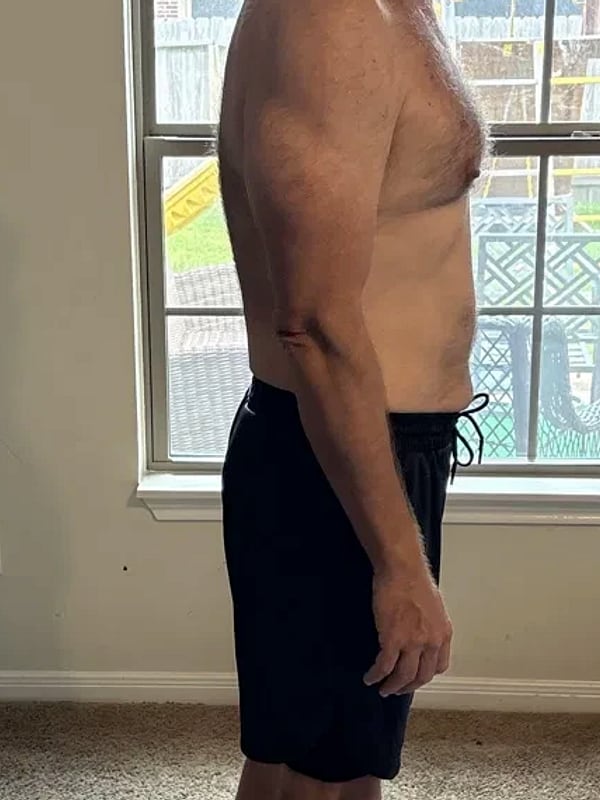 Jeff B., side profile midsection, after his plan.
