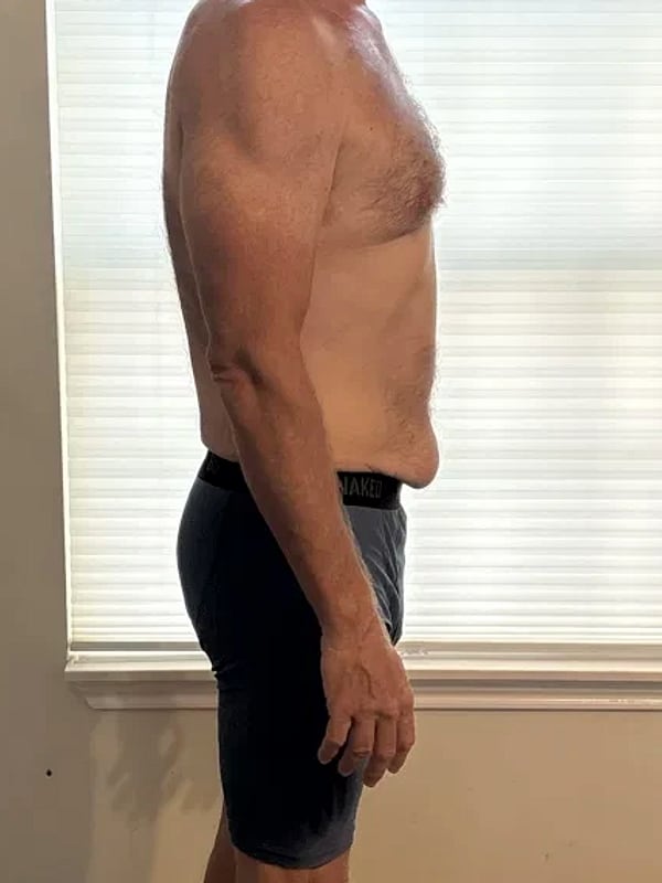 Jeff B., side profile midsection, before his plan.