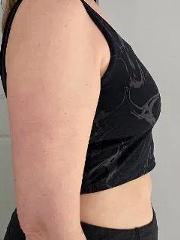 Katie P., side profile midsection, after her plan.